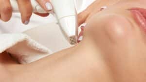 Mara - radiofrequency skin tightening feature