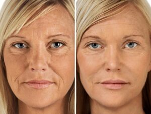 maras fountain of youth facial