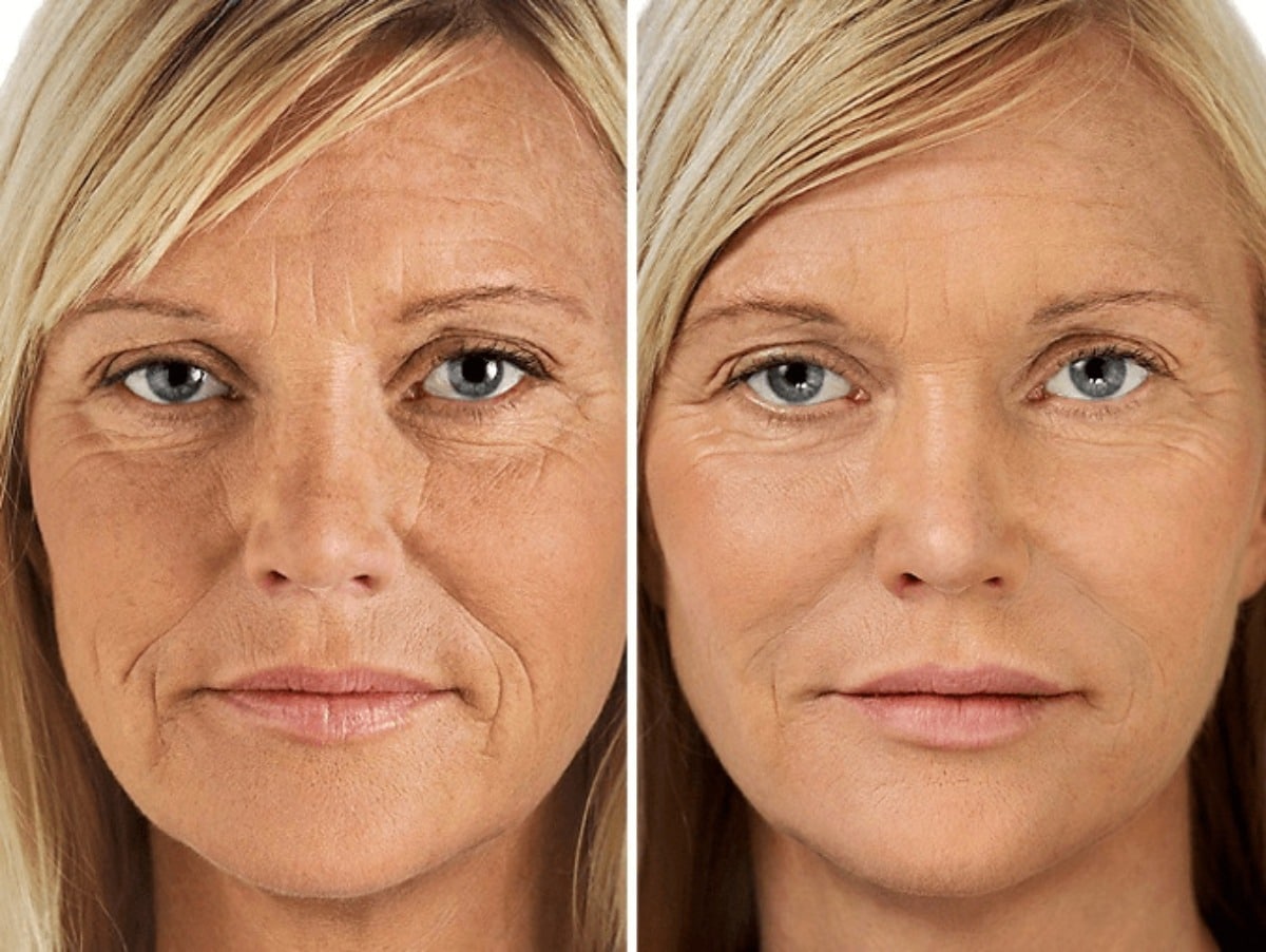 maras fountain of youth facial