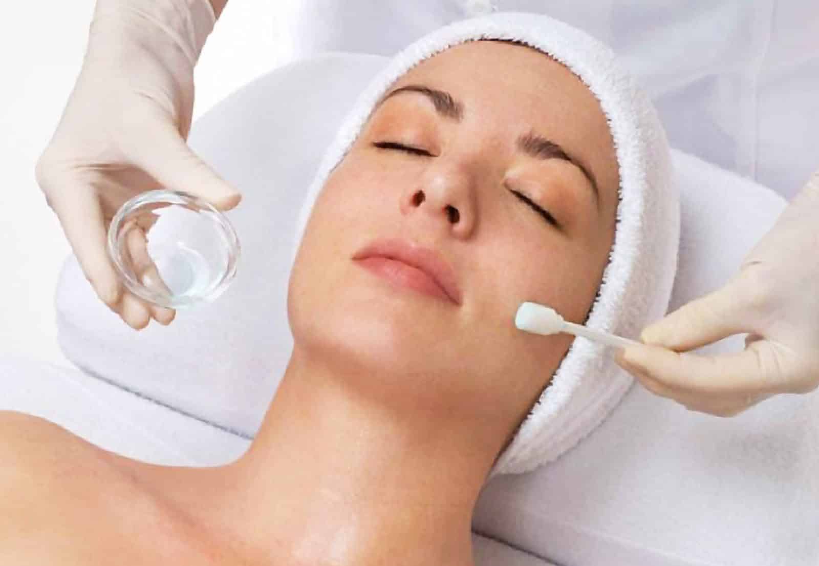 Maras chemical peel