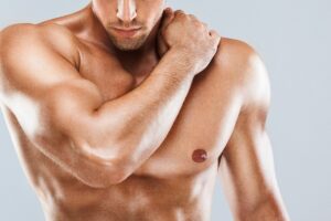 Coolsculpting For Men In Austin
