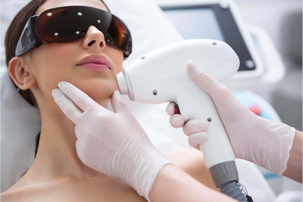 mara laser facial hair removal