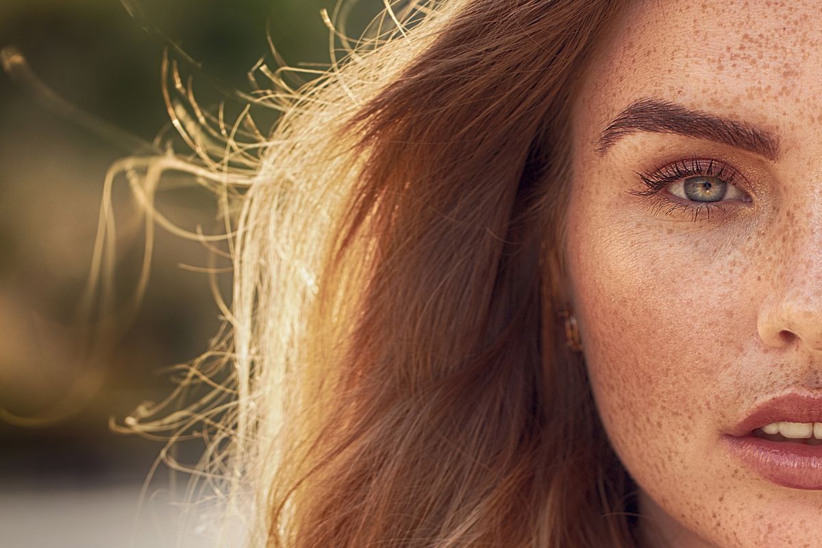 Mara-treating-sun-damaged-skin-1