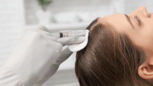 Hair Restoration In Austin