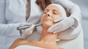 Microneedling In Austin