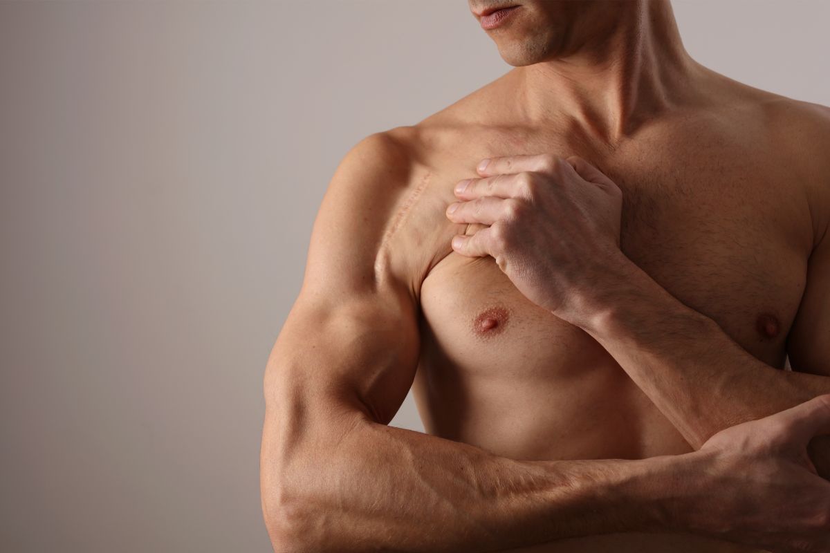 Mara-laser-scar-reduction-2