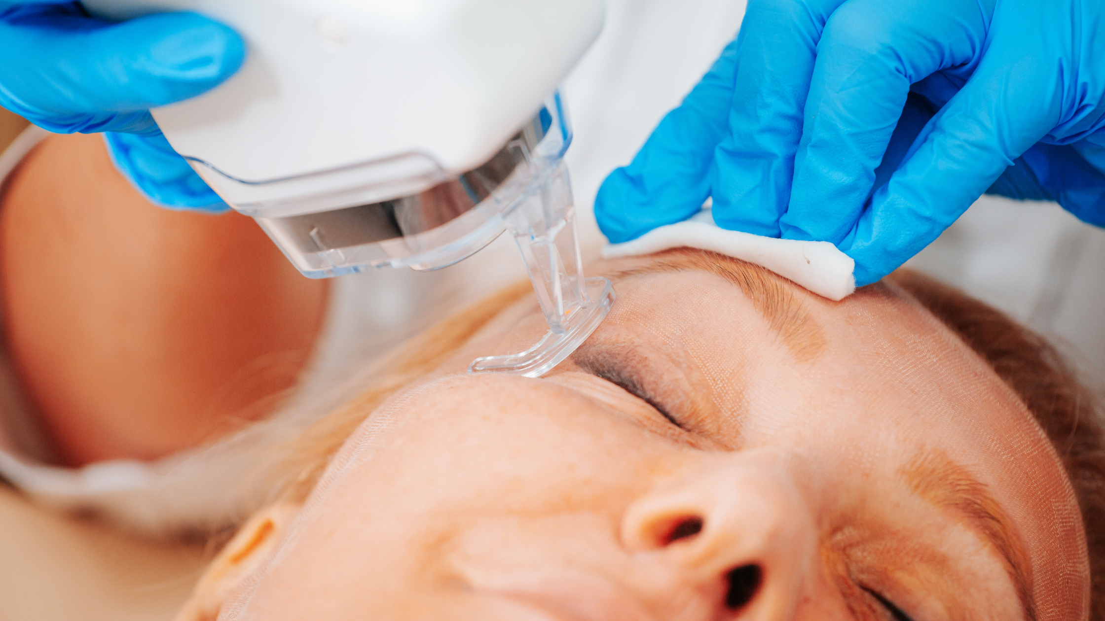 Laser Resurfacing Treatments In Austin