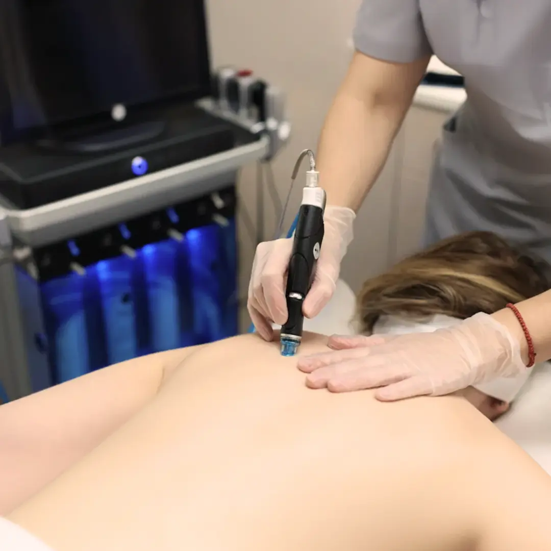 Hydrafacial Back Treatment in Austin