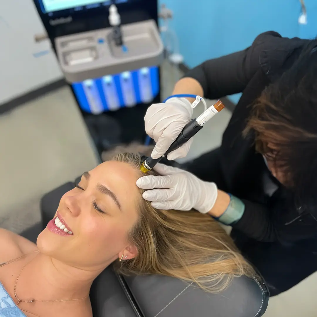 Hydrafacial Keravive scalp treatment in Austin